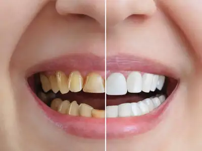 Cosmetic & Restorative Dentistry