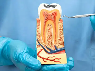 Endodontics