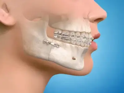 Oral & Maxillofacial Surgery
