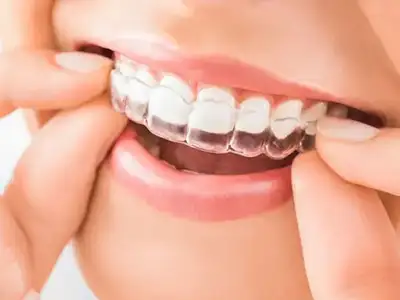 Orthodontics